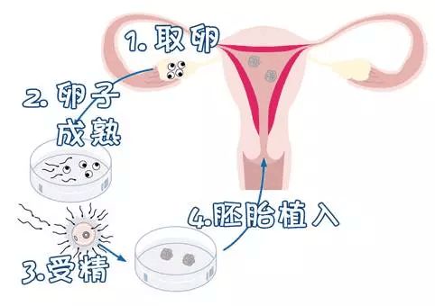 长头型